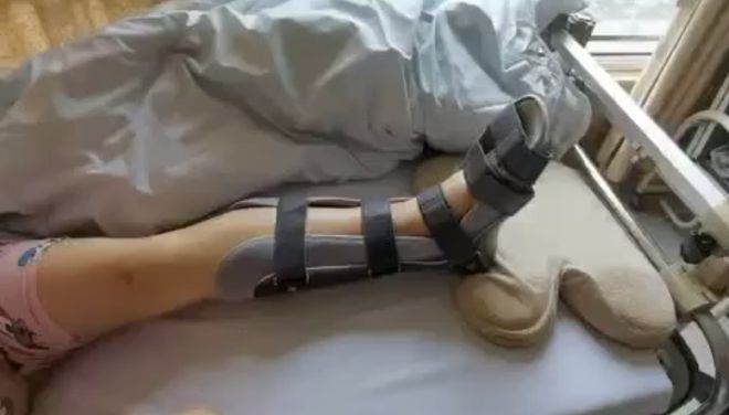 杭州一女子体验网红运动结果骨折了……店家回应：摔的姿势不正确！(图2)