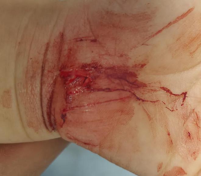 武汉一小区刀子跑道伤人！业主怒了