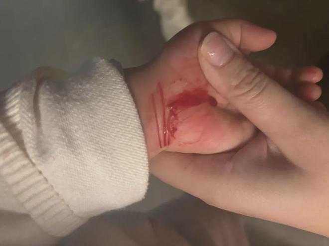 武汉一小区刀子跑道伤人！业主怒了(图2)